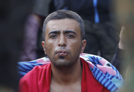 A migrant with his mouth sewn shut in protest sits at the border with Greece near the village of Gevgelija, Macedonia November 23, 2015. Conditions for hundreds of migrants stuck on Balkan borders worsened on Sunday as temperatures dropped and a first smattering of snow fell. REUTERS/Ognen Teofilovski