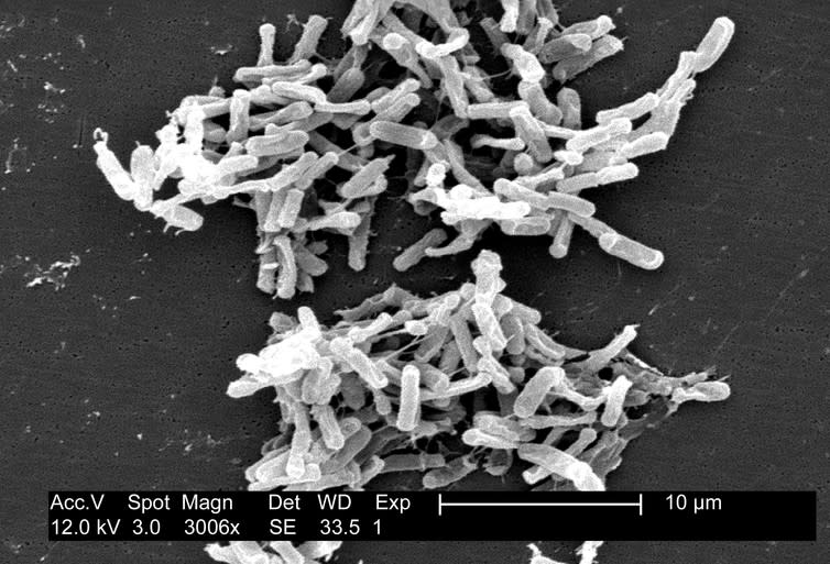 <span class="caption">Scanning electron micrograph of Clostridium difficile bacteria from a stool sample.</span> <span class="attribution"><span class="source">CDC/ Lois S. Wiggs/wikimedia</span></span>