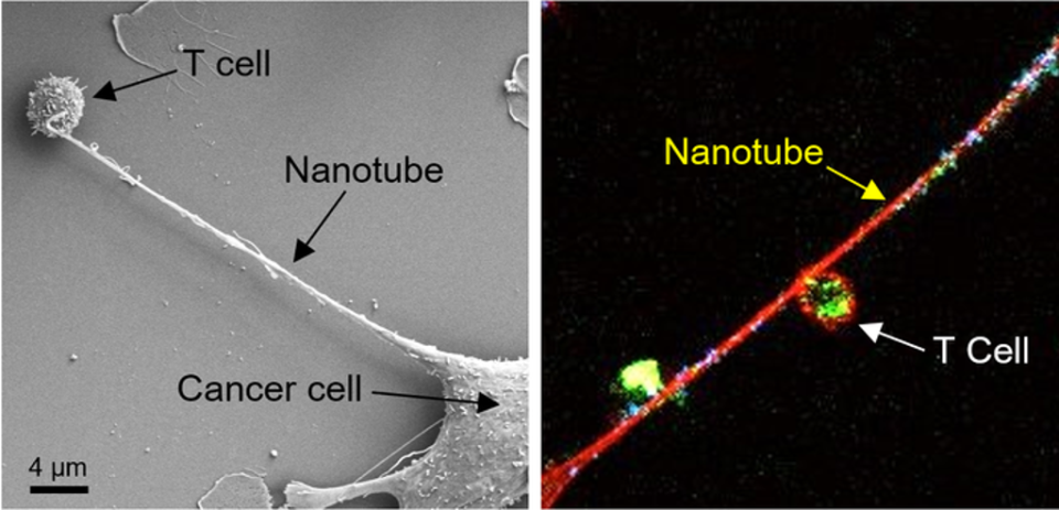 Left: Microscopic image shows formation of a nanotube between a breast cancer cell and an immune cell. Right: Image shows mitochondria (labeled with green fluorescence dye) traveling from a T cell to a cancer cell through the intercellular nanotube (Nature Nanotechnology)