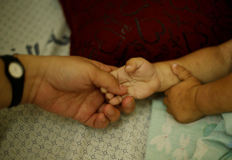 <p>The mother of Palestinian boy Ahmed Abbas, who suffers from cystic fibrosis, holds his hand as he lies on a hospital bed in Gaza City July 2, 2017. Picture taken July 2, 2017. (Photo: Mohammed Salem/Reuters) </p>