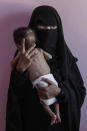 <p>Aisha Mohammed holds her son, 7 month-old Ahmed Rashid Mokbel, who is severely malnourished, weighing only 3.3 kilograms (7 pounds), in this Feb. 13, 2018 photo taken at Al-Sadaqa Hospital in the southern Yemeni city of Aden. Mohammed herself weighs only 39 kilograms (86 pounds) and has two other malnourished children. After fleeing to Aden from their home near Yemenâs Red Sea coast to escape fighting, she and her husband can barely afford food for the family. (Photo: Nariman El-Mofty/AP) </p>