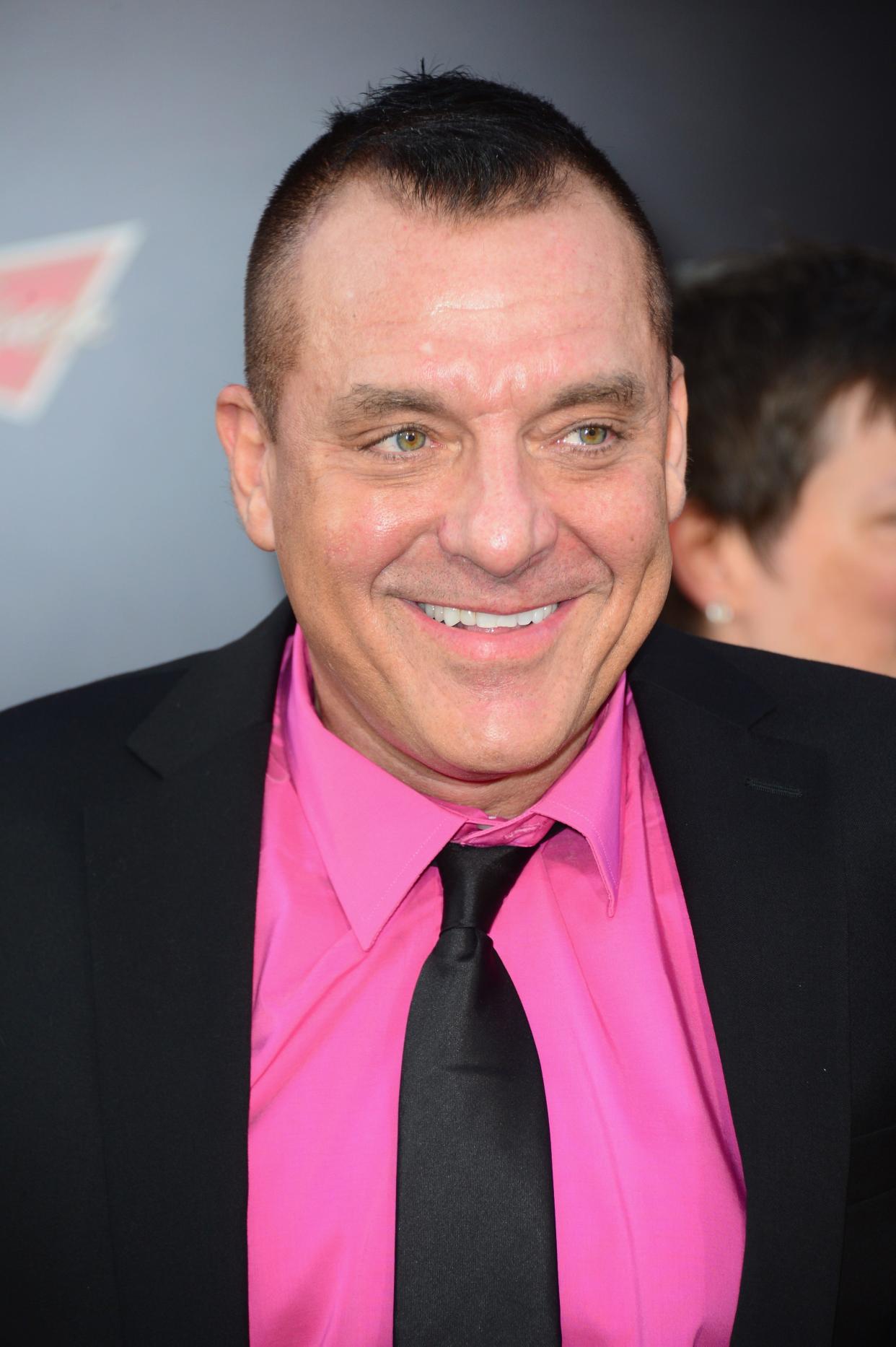 Actor Tom Sizemore has died at age 61, after suffering a brain aneurysm.