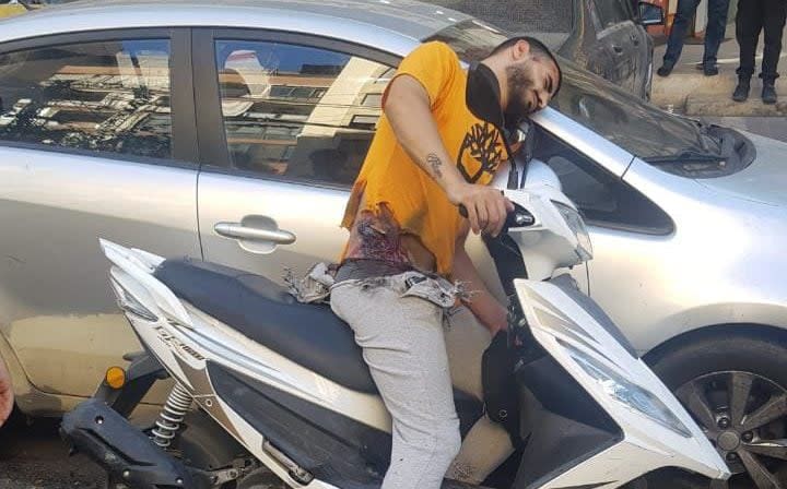 A pager exploded in this man's pocket as he drove through Beirut on his motorbike