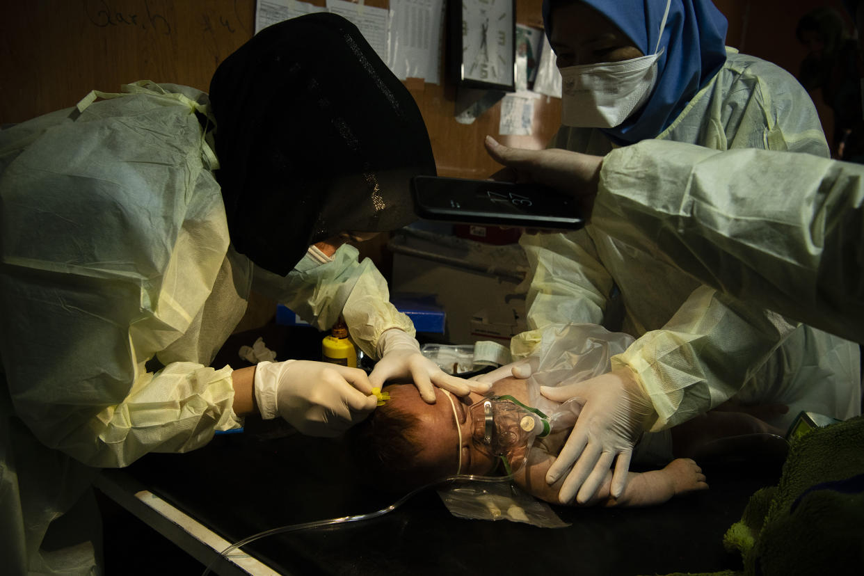 El personal sanitario pesaba a un niño en un centro de salud en la ciudad de Doolow en la región sureña de Gedo, en Somalia, en mayo. (Malin Fezehai/The New York Times)