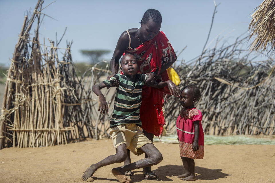 FILE - A mother helps her malnourished son stand after he collapsed near their hut in the village of Lomoputh in northern Kenya, Thursday, May 12, 2022. An international team of climate scientists says the ongoing drought in Eastern Africa has been made worse by human-induced climate change according to a report from World Weather Attribution. (AP Photo/Brian Inganga, File)