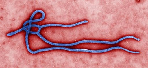 伊波拉(Ebola)病毒。(CDC/Cynthia Goldsmith)(Public domain)