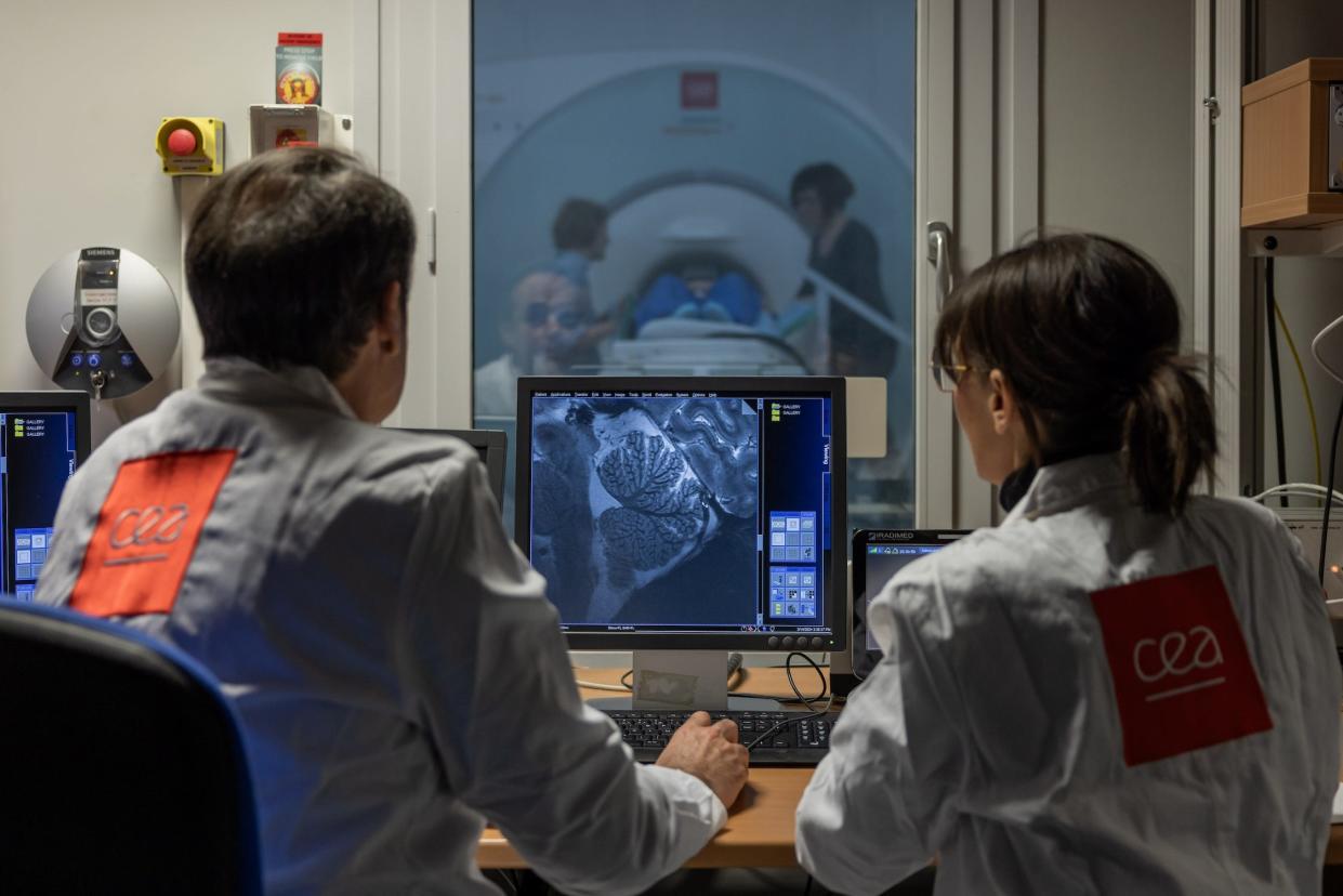 Researchers used the world's most powerful MRI to get brain scans that ...