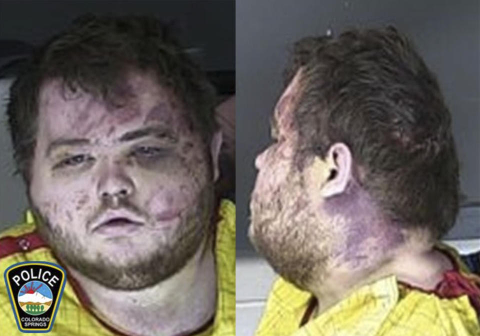 FILE - This booking photo provided by the Colorado Springs, Colo., Police Department shows Anderson Lee Aldrich, the suspect in a mass shooting that killed five people at a Colorado Springs LGBTQ+ nightclub last year, who pleaded guilty in the attack on Monday, June 26, 2023. (Colorado Springs Police Department via AP, File)