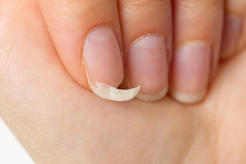 an up-close shot of a person's hangnail