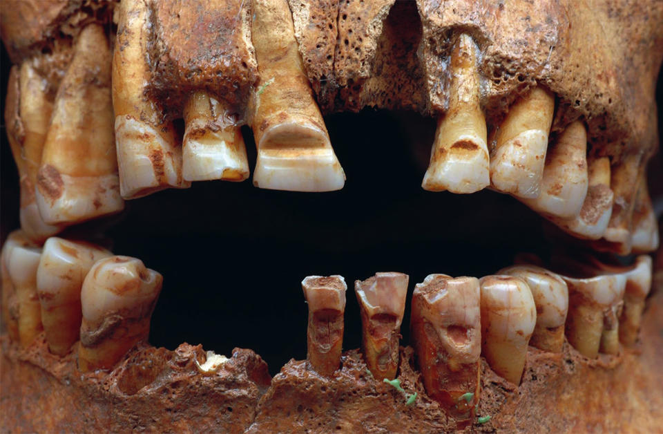 Detail of skull that shows deliberate grooves made on the front teeth.