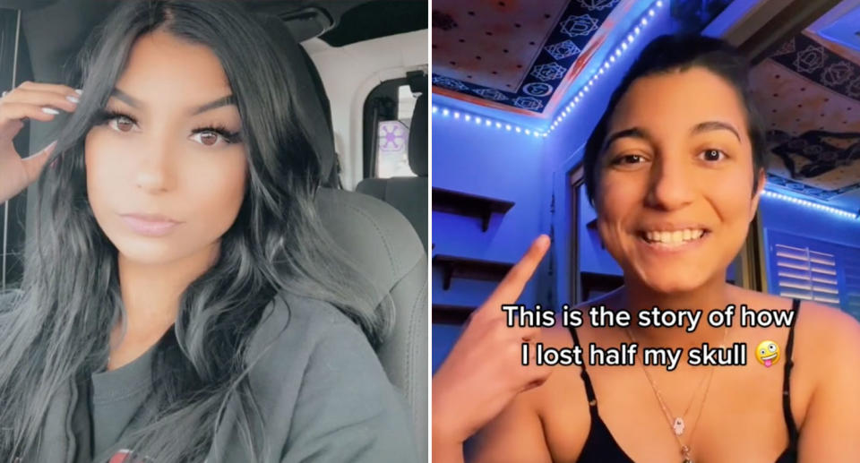 Natasha Alyena Gunther (pictured before her surgery on the left)  had part of her skull removed due to several sinus infections. Source: TikTok/natasha_gunther