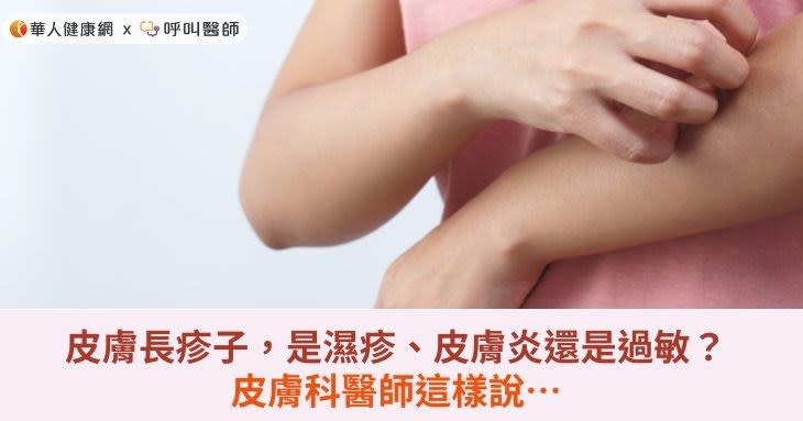 皮膚長疹子，是濕疹、皮膚炎還是過敏？皮膚科醫師這樣說…