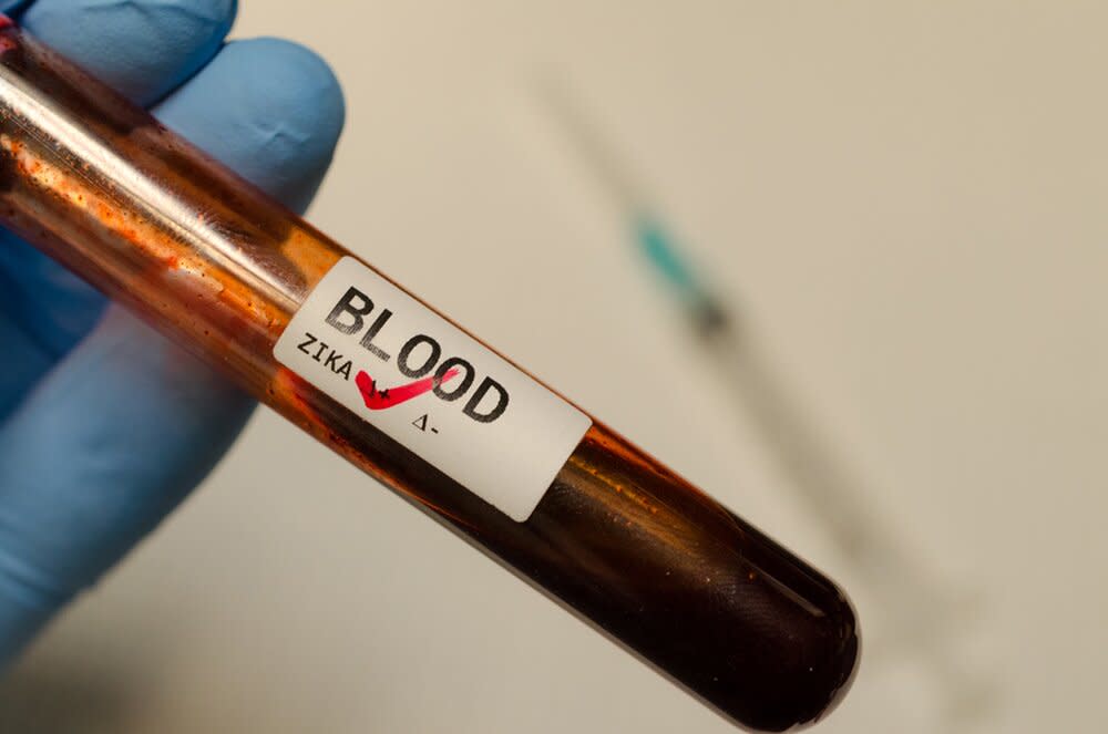 blood-test-positive-for-zika-virus.jpg