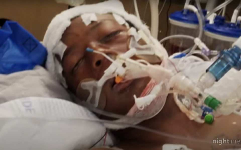 Elijah McClain, 23, is pictured in a hospital bed.