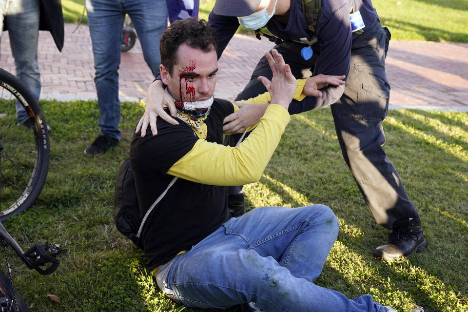 A counter-protester helps a supporter of President Donald Trump who was injured after he was attacked during a pro-Trump rally Saturday Nov. 14, 2020, in Washington. (AP Photo/Jacquelyn Martin)