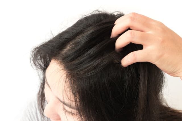 Closeup woman hand itchy scalp, Hair care concept