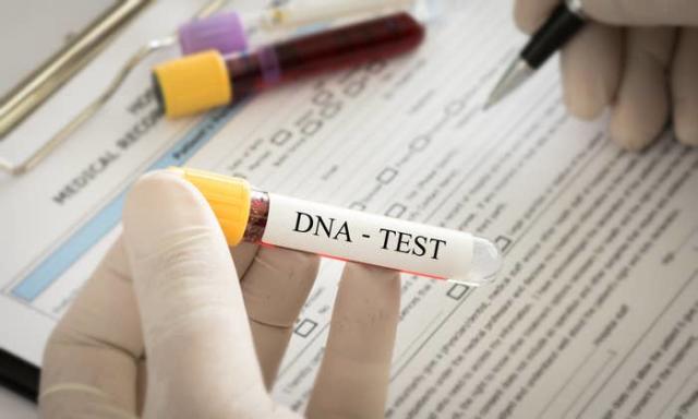 Wild Things People Found Out After Taking a DNA Test – Page 24