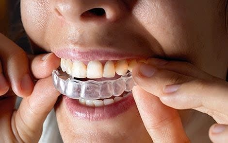 Invisalign is a popular invisible braces brand - Getty Images