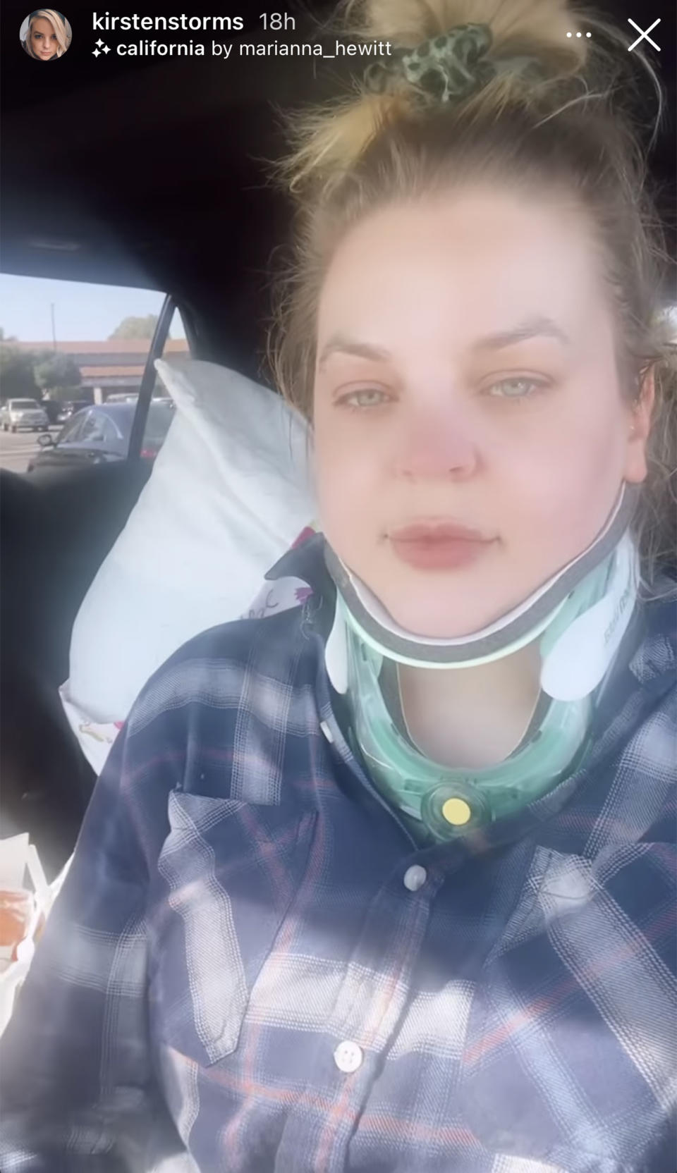 Kirsten Storms after her brain surgery. (kirstenstorms)
