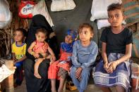 Yemeni boy fights malnutrition as hunger stalks nation's children