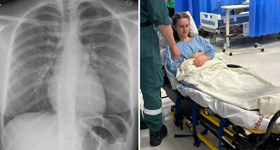 An X-ray of Paris's lungs (left) and an image of her in hospital (right). 