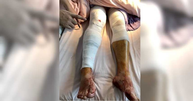 4名傷者送往金門醫院治療，其中1人傷勢嚴重。（圖／民眾提供）