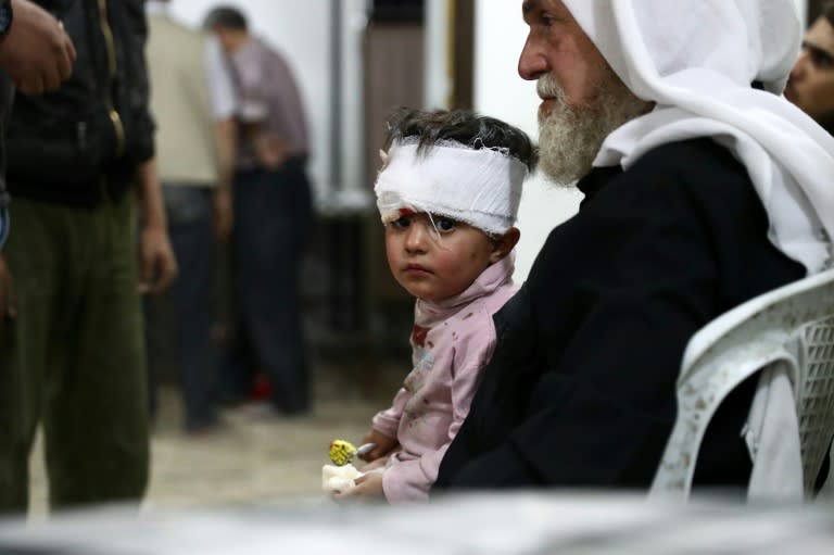 An injured Syrian child waits after receiving treatment at a makeshift hospital on October 3, 2016 following reported air strikes in the rebel-held town of Douma