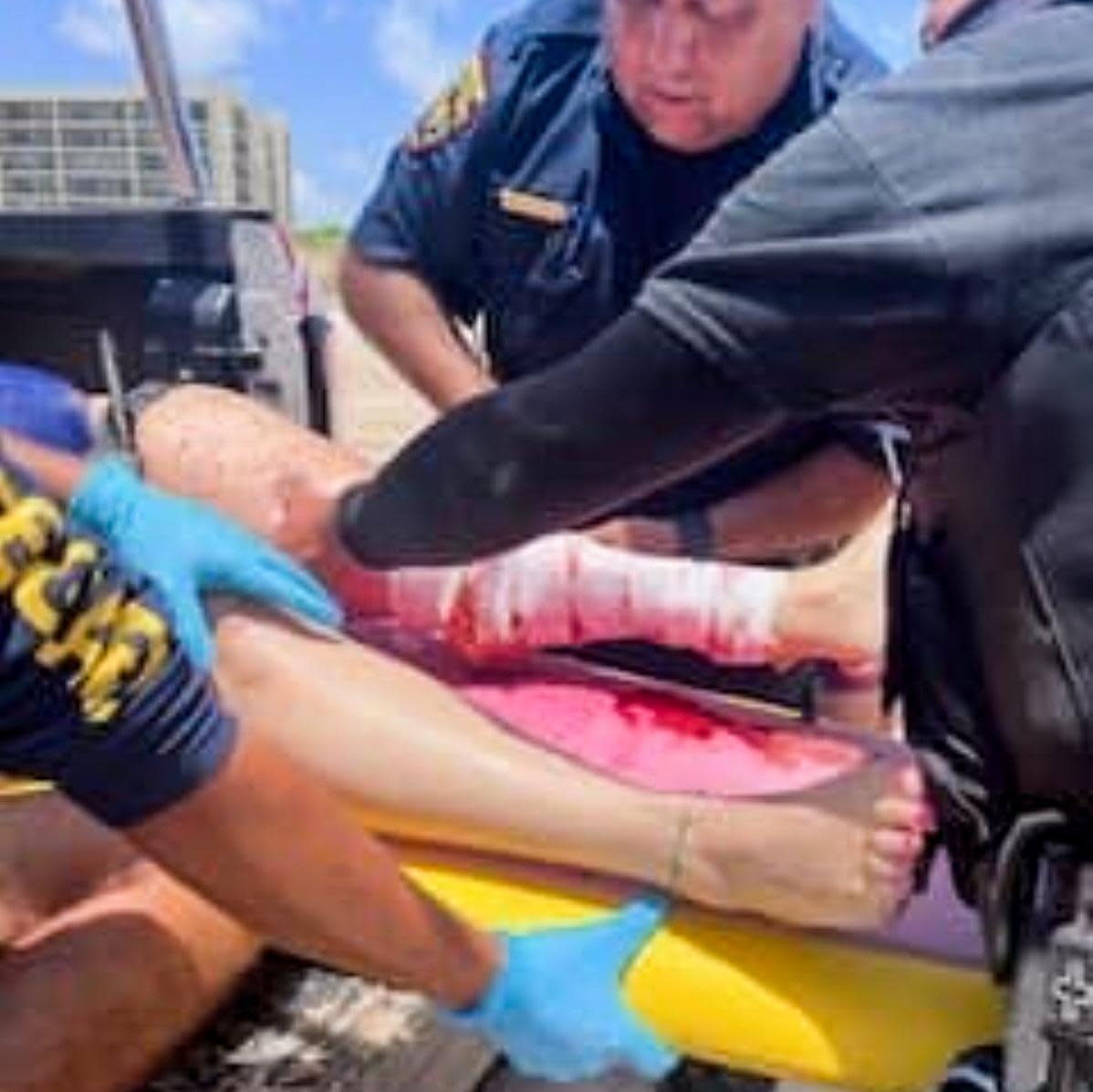 <span>US border patrol agents help a person who was bitten by a shark on South Padre Island, Texas, on 4 July 2024.</span><span>Photograph: US border patrol Laredo</span>