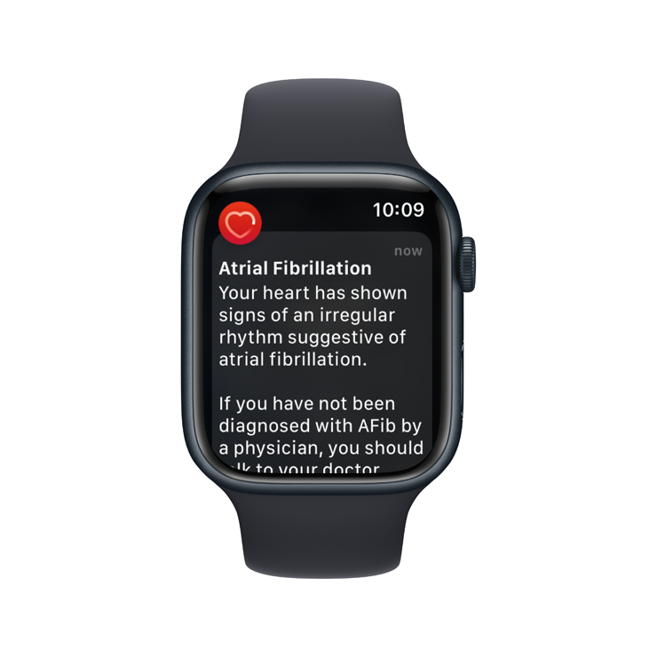 On Apple's Heart Rate app, you can turn on heart rate notifications that can alert you if your heart rate remains above or below a chosen threshold after you've been inactive for 10 minutes. You can also set up irregular heartbeat notifications or show atrial fibrillation history. (Image by Vanessa Kissoon)