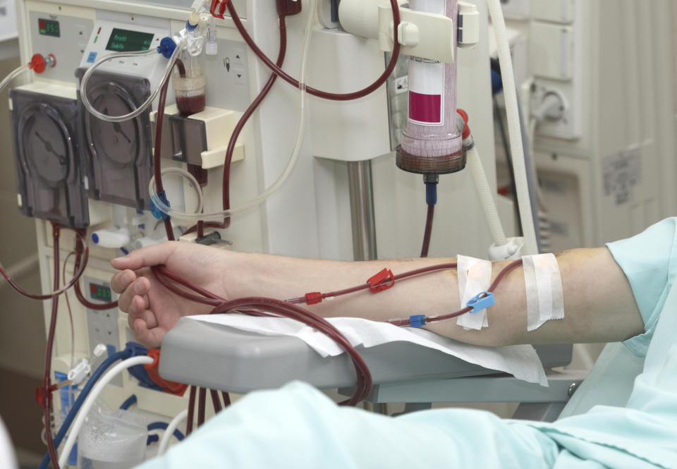 A patient in a hospital bed, with tubes in their arm as they receive kidney dialysis.