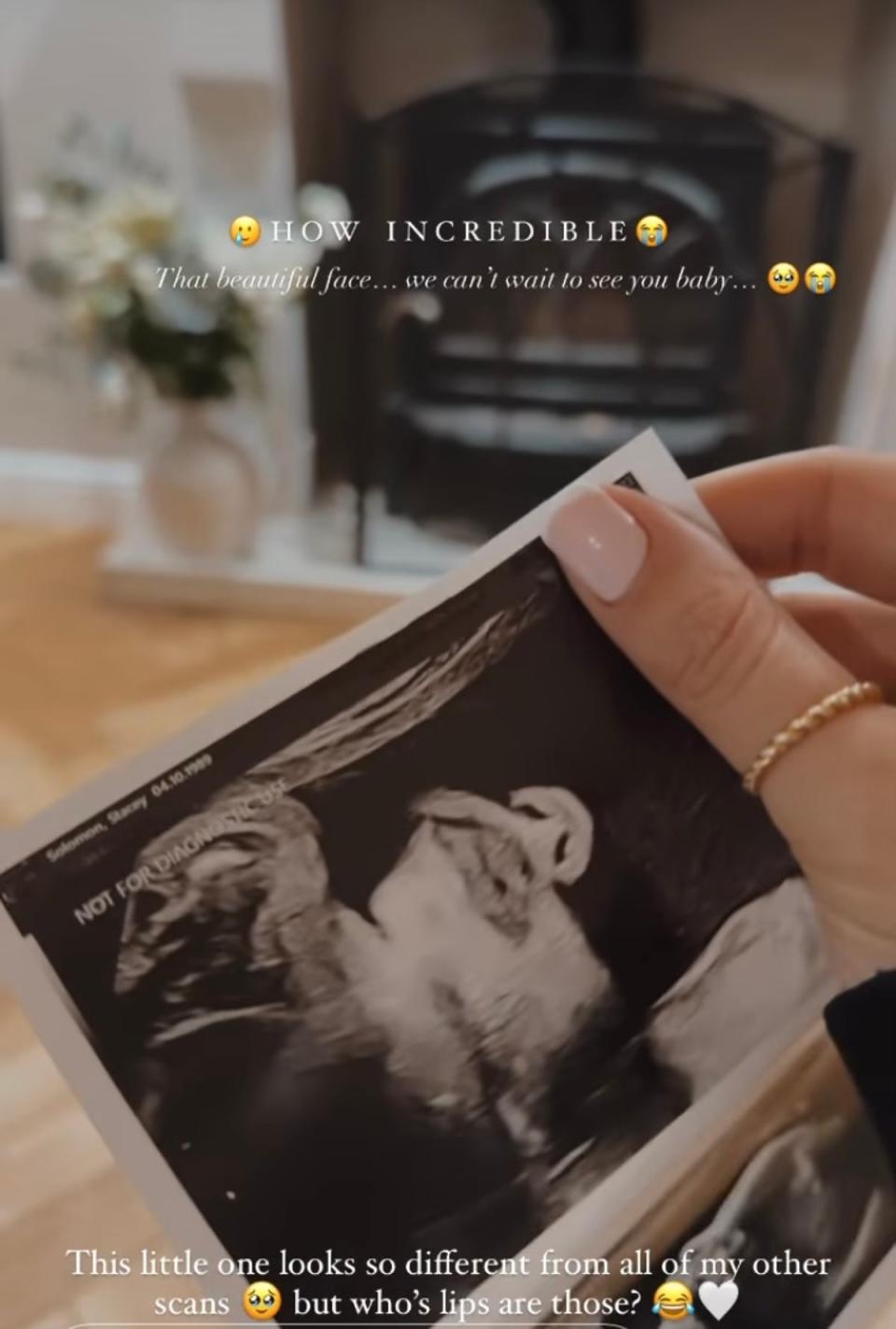 The Loose Women star was blown away by how detailed her baby scan was (Instagram)