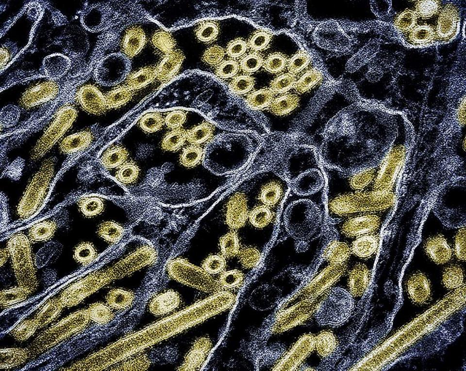 <span>This handout picture courtesy of CDC and NIAID released on May 24, 2024 shows a colorized transmission electron micrograph of avian influenza A H5N1 virus particles (gold), grown in Madin-Darby Canine Kidney (MDCK) epithelial cells </span><div><span>CDC and NIAID</span></div>