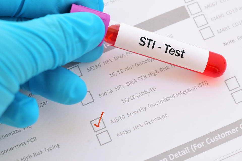 a gloved hand holding a tube of blood labeled "STI Test"