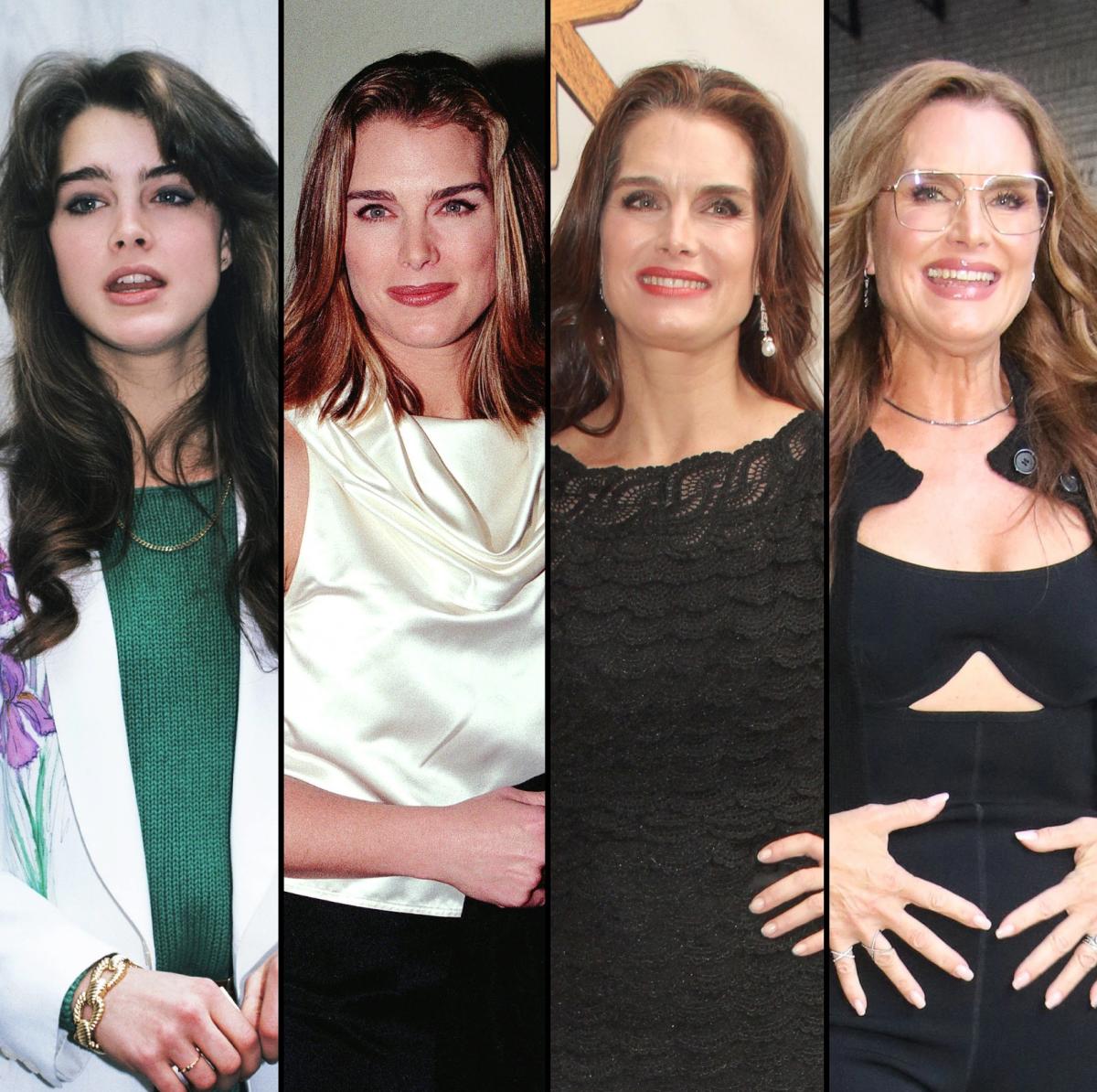 Has Brooke Shields Had Plastic Surgery Her Transformation Over The Years And What Work Shes 