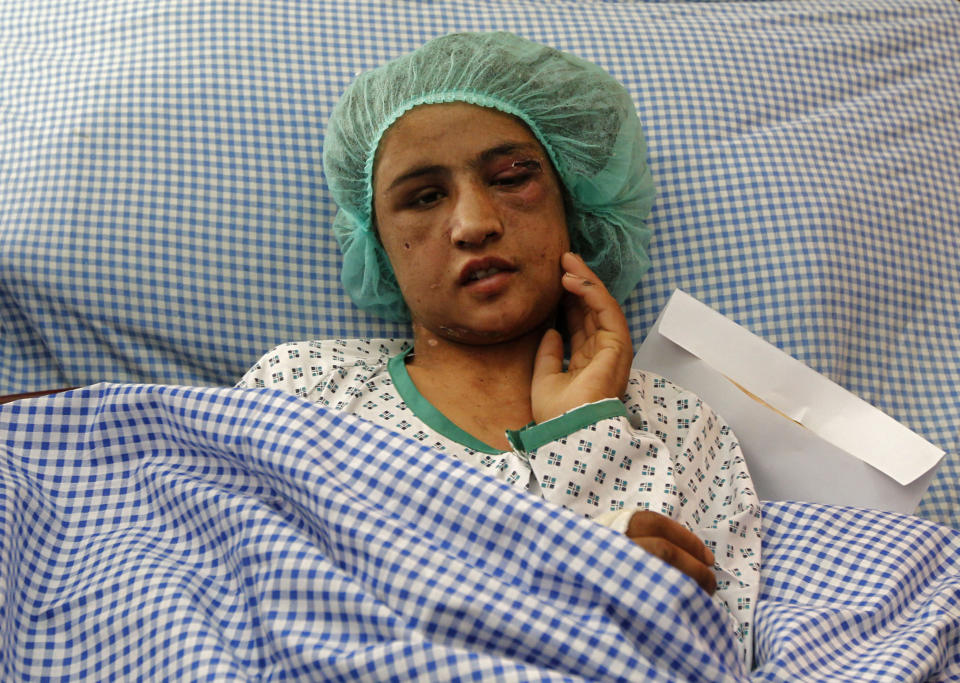 An Afghan girl who was tortured for months after refusing prostitution lies on a hospital bed in Kabul