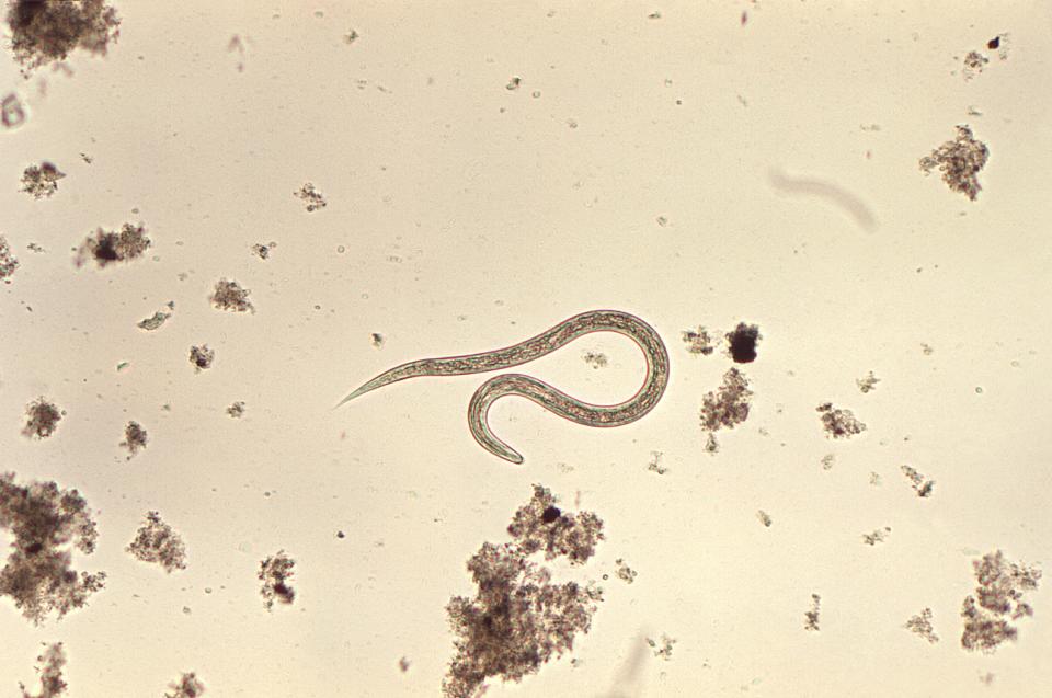 A hookworm parasite. (Photo: Smith Collection/Gado via Getty Images)