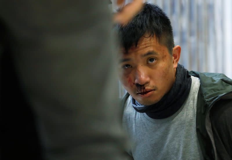 An injured anti-government protester is seen detained inside the Sheung Shui shopping mall in Hong Kong