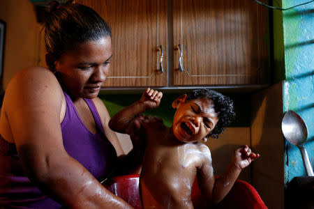 Tatiana Rocha, baths her son Kaleth Heredia, 2, a neurological patient being treated with anticonvulsants, at their house in Caracas, Venezuela February 8, 2017. REUTERS/Carlos Garcia Rawlins