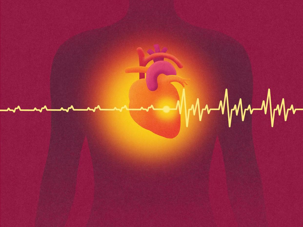 Scientists have designed a solar panel-like pacemaker that can precisely control heartbeats. <a href="https://www.gettyimages.com/detail/photo/female-silhouett-and-heart-with-pacemaker-royalty-free-image/1490726996" rel="nofollow noopener" target="_blank" data-ylk="slk:Eugene Mymrin/Moment via Getty Images;elm:context_link;itc:0;sec:content-canvas" class="link ">Eugene Mymrin/Moment via Getty Images</a>