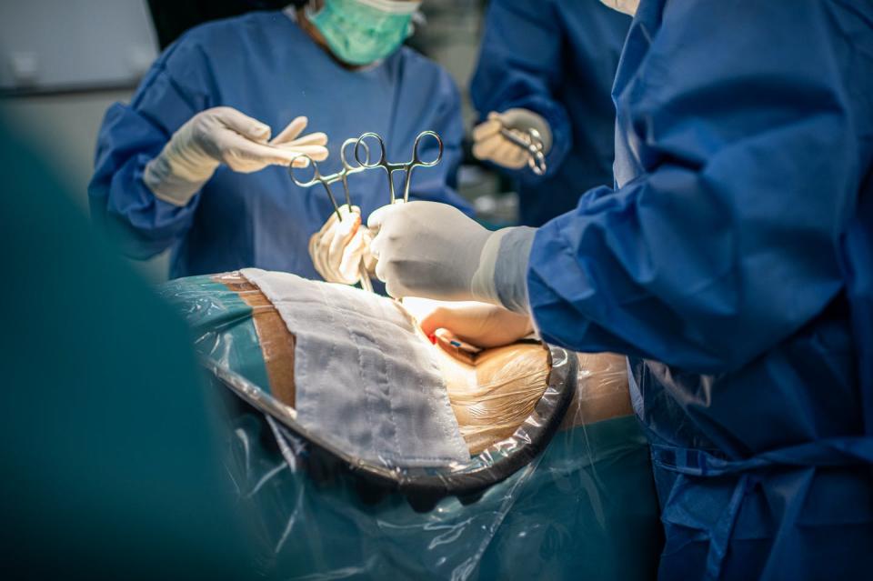   <span class="attribution"><a class="link " href="https://www.shutterstock.com/es/image-photo/classic-cesarean-section-operating-theater-labor-1548176843" rel="nofollow noopener" target="_blank" data-ylk="slk:Shutterstock / Natthawon Chaosakun;elm:context_link;itc:0;sec:content-canvas">Shutterstock / Natthawon Chaosakun</a></span>