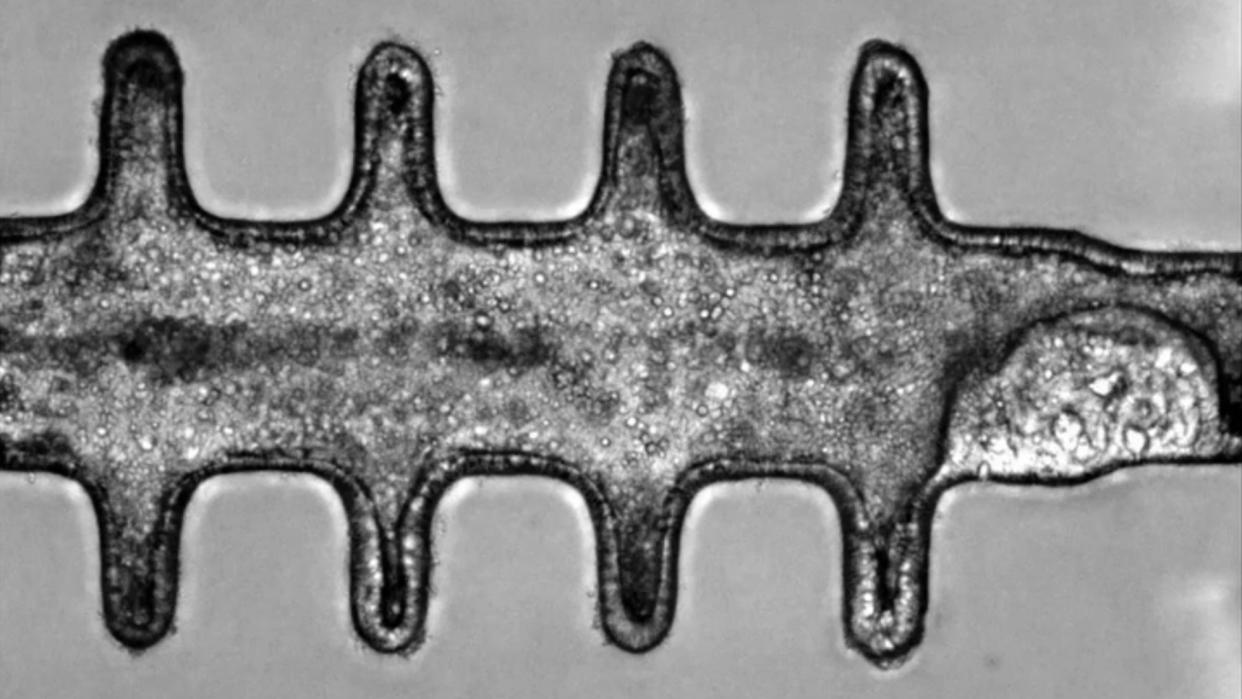  Microscope image shows a tube-like structure with four "spikes" or extended-out bits on the top and four on the bottom. A tumor can be seen beginning to form in the bottom right-hand side of the structure. 