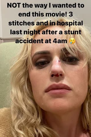 <p>Rebel Wilson/Instagram</p> Rebel Wilson's Instagram Story discussing her injury, via Entertainment Online.