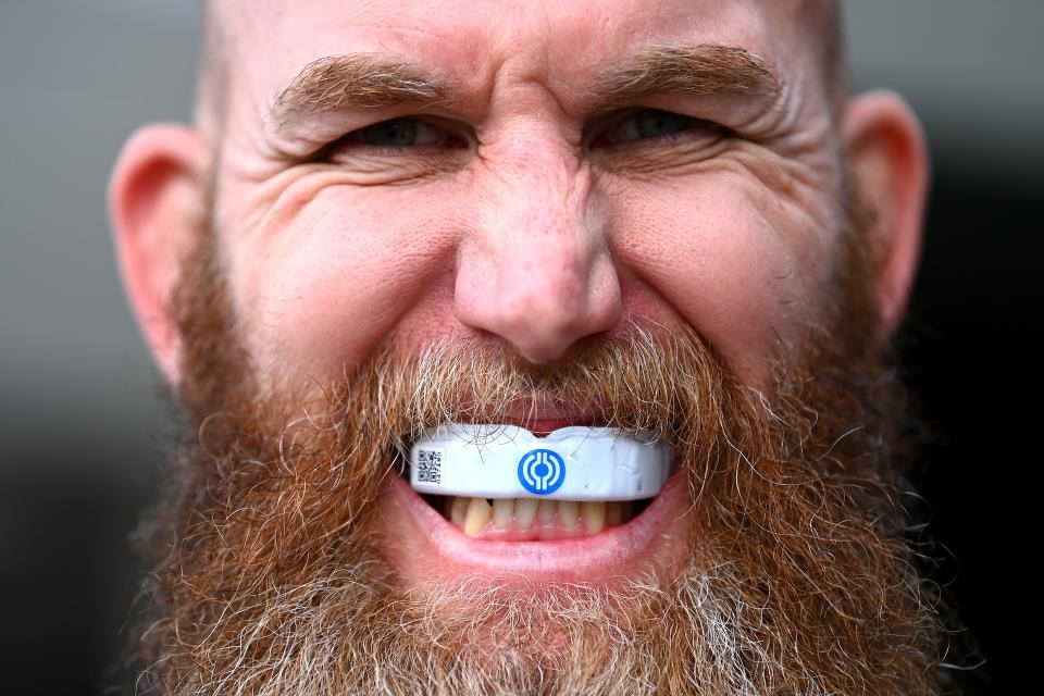 A rugby player wearing a Prevent Biometrics mouthguard. (Hannah Peters/World Rugby via Getty Images)