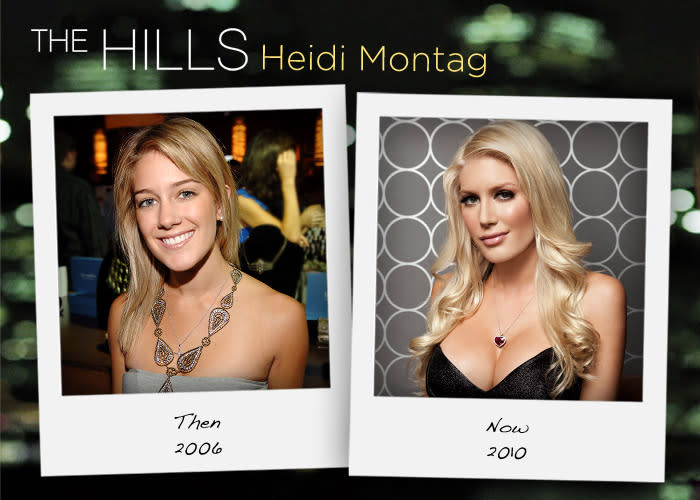 The Hills Cast Now & Then