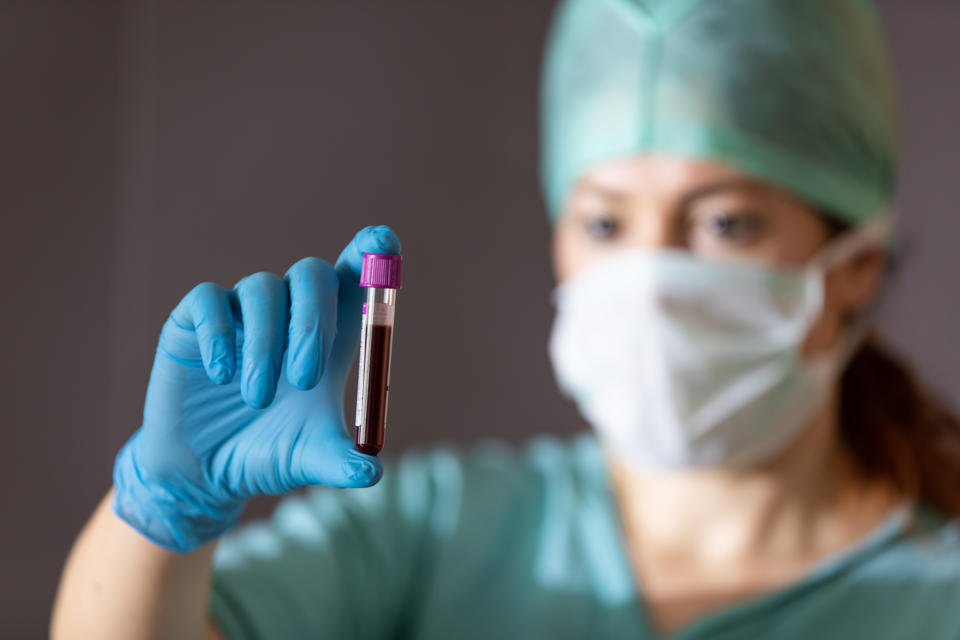 There could be a connection between a person’s blood type and their coronavirus risk. (Photo: Getty Images)