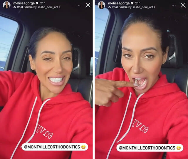 Melissa Gorga Embed