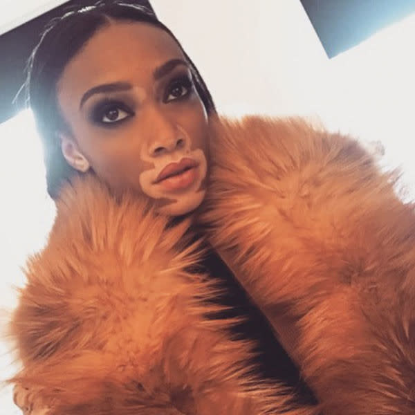 <p>Is dating Candian model Winnie Harlow, whose YouTube video “Vitiligo: A Skin Condition, not a Life Changer”, was an Internet sensation </p>