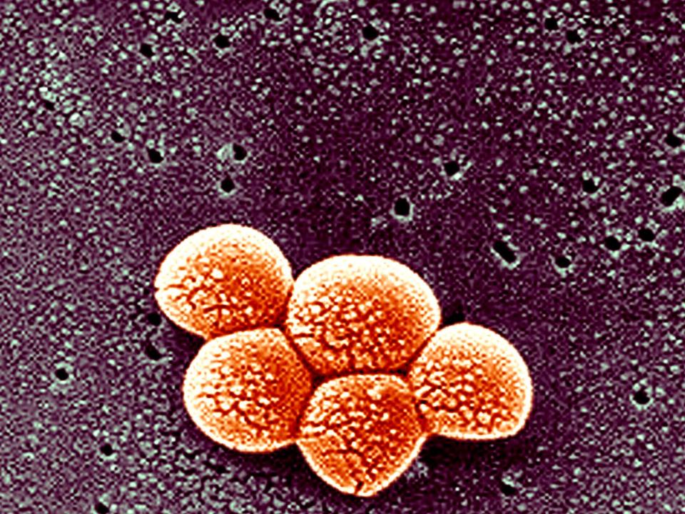 MRSA bacteria