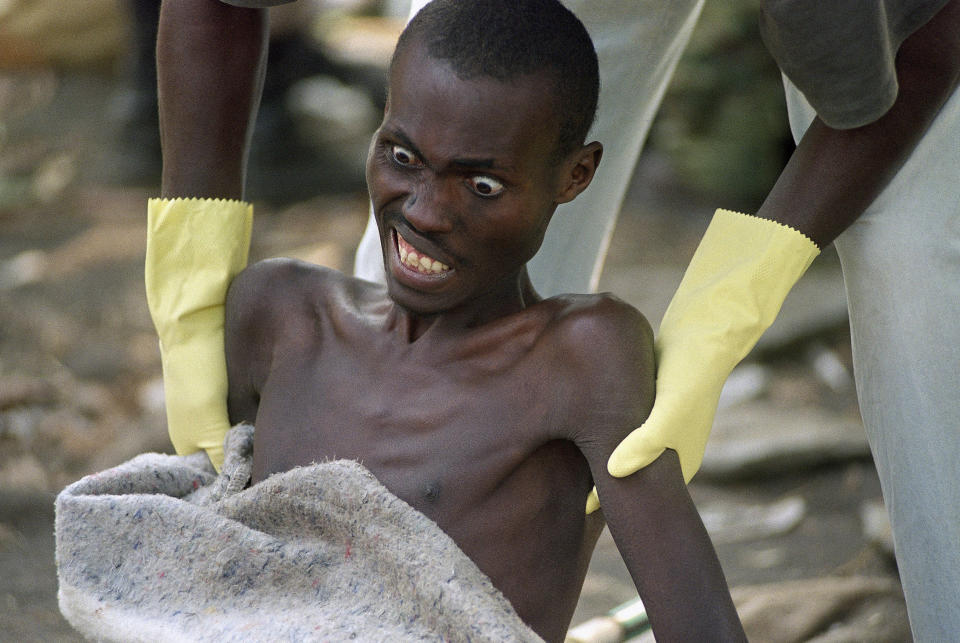 FILE - A Zairean relief worker lifts a severely ill Rwandan refugee at the Mugunga camp near Goma, Zaire, now Congo, on July 29, 1994. (AP Photo/Jockel Finck, File)