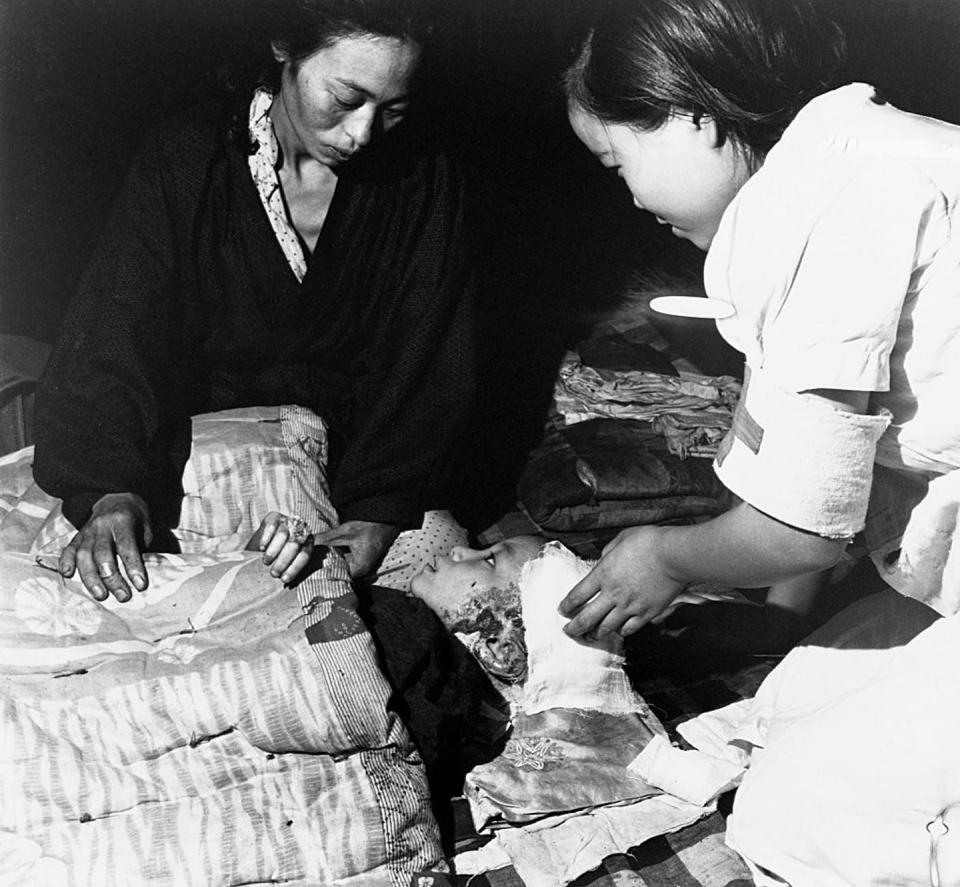 A child hurt in the atomic bomb blast at Hiroshima, Japan, receives care from her mother and a nurse’s aide. <a href="https://www.gettyimages.com/detail/news-photo/bandaged-child-hurt-in-the-atomic-bomb-blast-at-hiroshima-news-photo/615316474?adppopup=true" rel="nofollow noopener" target="_blank" data-ylk="slk:Corbis Historial via Getty Images;elm:context_link;itc:0;sec:content-canvas" class="link ">Corbis Historial via Getty Images</a>